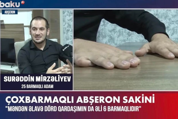  25 barmaqlı Surəddin: “Mənimlə bərabər, dörd qardaşımın da əlində altı barmaq var” - VİDEO 