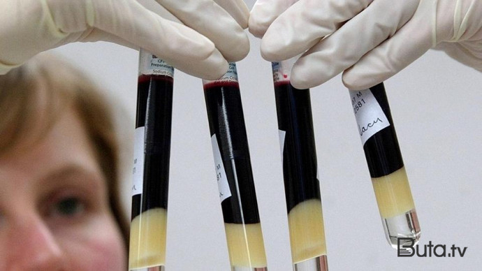  Diqqət: Yeni ölümcül infeksiya yayılır  