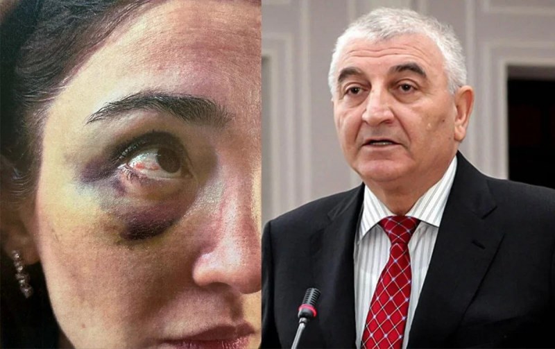  Keçmiş gəlinindən Məzahir Pənahova İTTİHAM: 